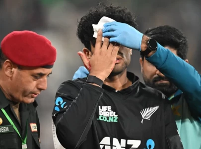 Watch: Rachin Ravindra bleeds after head blow while fielding